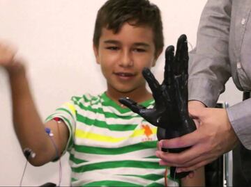Desarrollan prótesis robóticas para niños