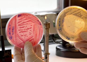 Anticuerpos "armados" con antibióticos vencen bacterias resistentes