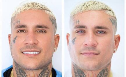 Osmani García desata polémica tras someterse a riesgoso procedimiento para cambiar el color de sus ojos