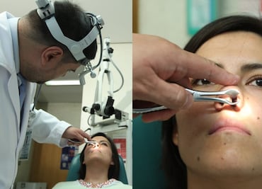 IMSS atendió a más de 600 por tumor maligno de fosa nasal