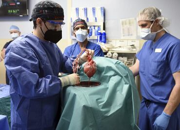 Trasplantan con éxito corazón de cerdo a una persona