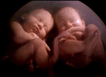 La transmisión más lenta de oxígeno en la placenta hace a un gemelo más listo