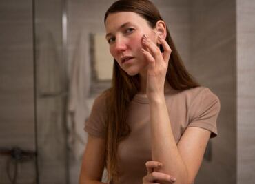 Descubre la mejor vitamina para el acné