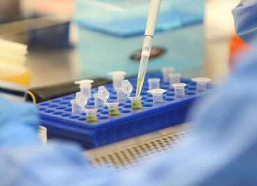 Zika aumenta casos del síndrome que causa parálisis: estudio