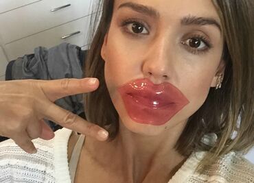 ¿Parches para labios? Nosotros te decimos qué son y cómo usarlos