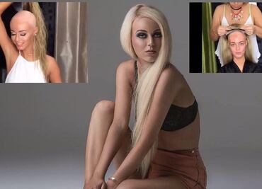 Modelo australiana muestra su lucha contra la alopecia