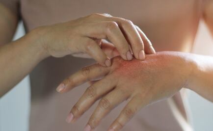 El trastorno que hace que tengas que rascarte continuamente