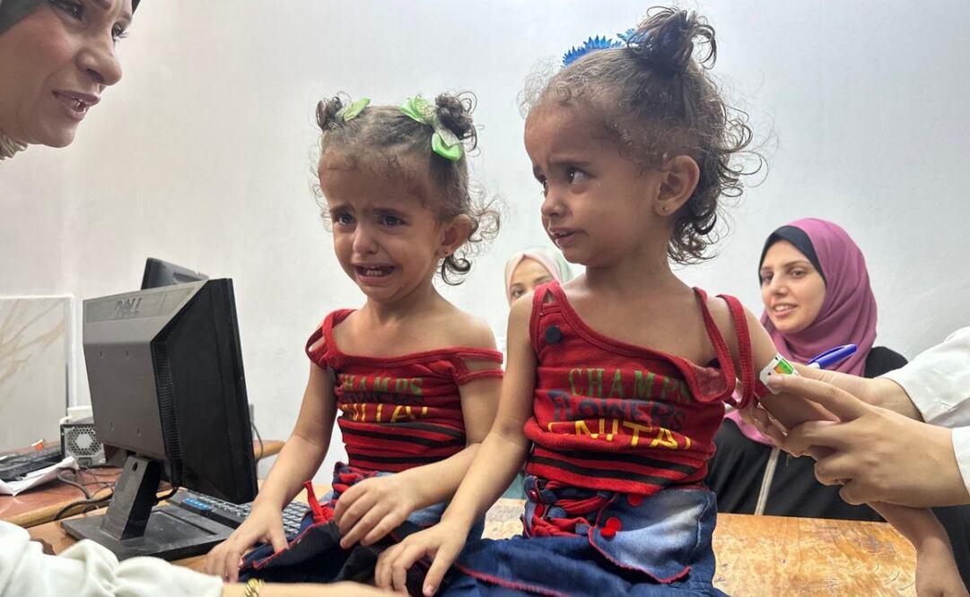 El Hospital de la Sociedad Benéfica de Amigos del Paciente de Ciudad de Gaza está atestado de madres ojerosas y niños cabezudos con cuerpos demasiado pequeños; ojos hundidos, tripas hinchadas y brazos diminutos. Foto: EFE