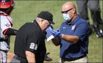 Batazo provoca hemorragia a umpire en Grandes Ligas