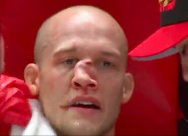 VIDEO. Pelador de MMA recibe brutal golpe que le desfigura la nariz