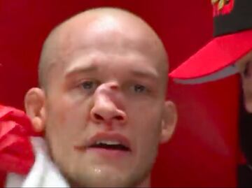 VIDEO. Pelador de MMA recibe brutal golpe que le desfigura la nariz