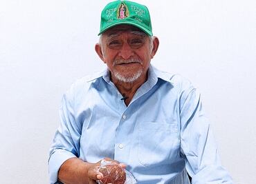 IMSS extrae “piedra gigante” de 250 gramos de vejiga de un adulto mayor en Yucatán