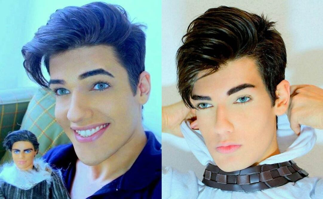 Santebañes se sometió a decenas de intervenciones estéticas ya que su objetivo era parecerse al personaje ficticio "Ken", pareja de la muñeca Barbie. FOTOS:Facebook
