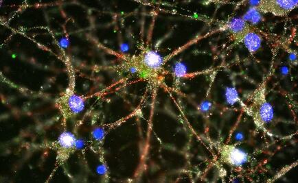 Estudio sugiere biología de la esquizofrenia