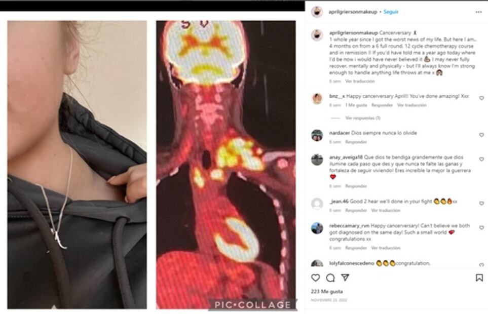 Va al médico por una picazón y le detectan cáncer