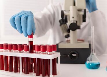 Informe acusa a gobiernos británicos de encubrir escándalo de sangre contaminada que dejó cerca de 3 mil muertos en Reino Unido