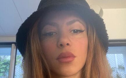 Cómo combatir la plaga que incomoda a Shakira en su nueva casa de Miami