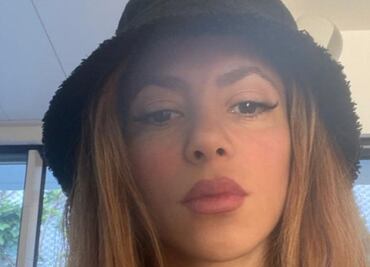 Cómo combatir la plaga que incomoda a Shakira en su nueva casa de Miami