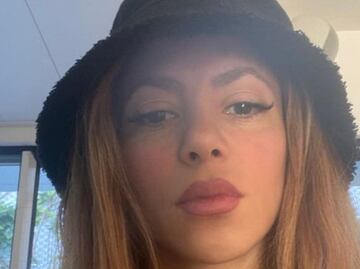 Cómo combatir la plaga que incomoda a Shakira en su nueva casa de Miami