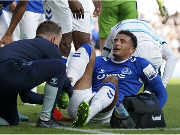 VIDEO: La terrible lesión de un jugador del Everton por culpa del VAR