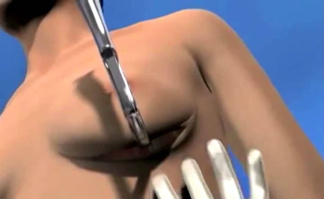 La clínica se encuentra asegurada por la Fiscalía de Puebla mientras se determina si la mujer realmente falleció por los paros cardíacos que sufrió durante su intervención. FOTO: ESPECIAL