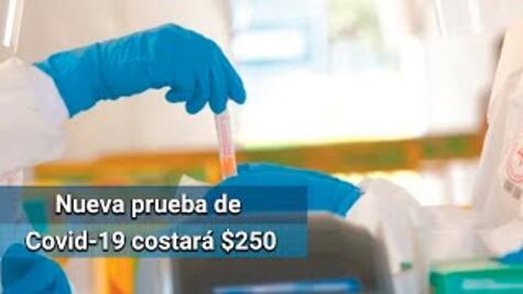 Expertos trabajan en nueva prueba para detectar el Covid-19 de forma rápida y económica