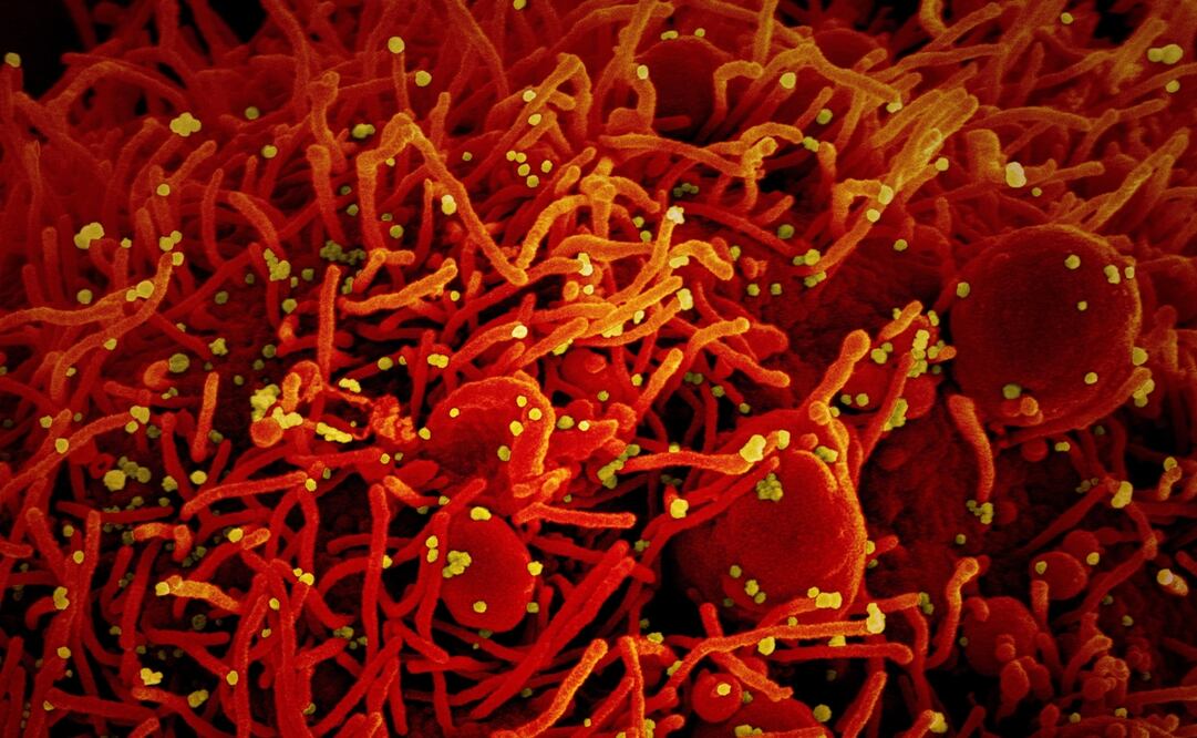 Foto: EFE/EPA/NIAID/National Institutes of Health, archivo