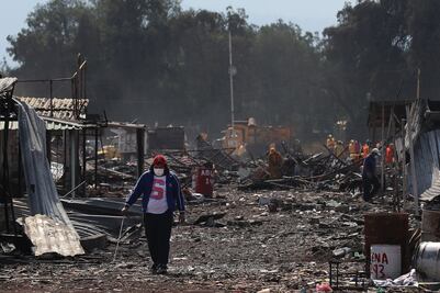 Harán cirugías de regeneración de piel a víctimas de Tultepec