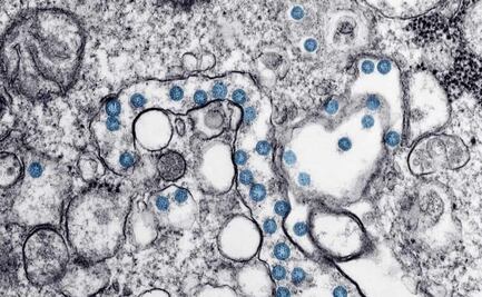 Descubren la proteína que provoca que nos enfermemos de Covid-19