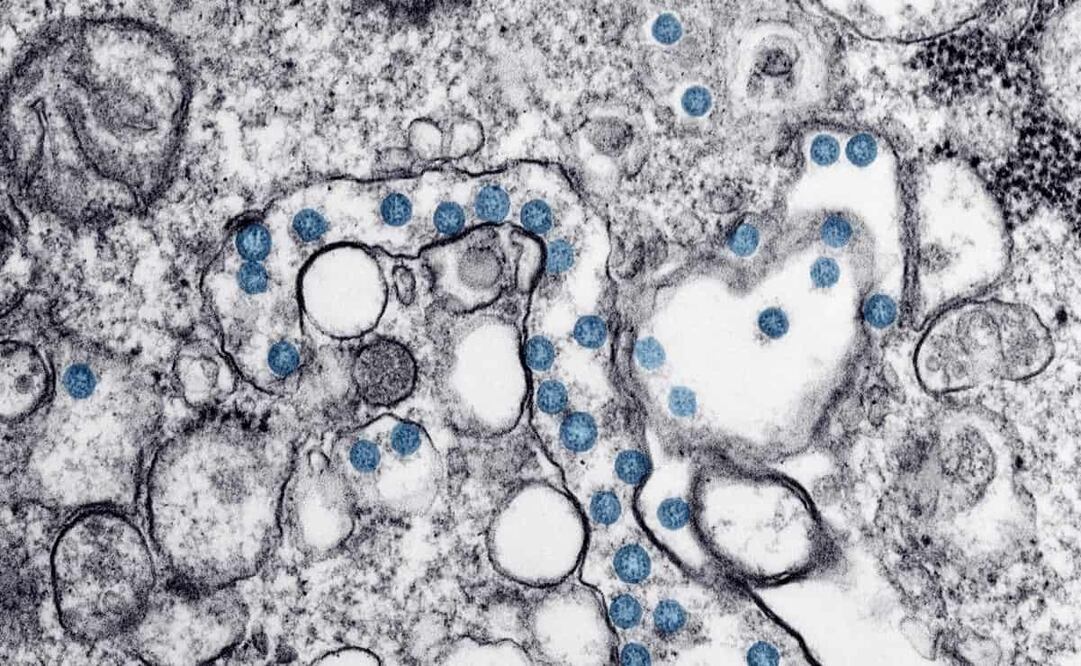 El coronavirus. Foto: Hannah A. Bullock, Azaibi Tamin/CDC via AP, archivo