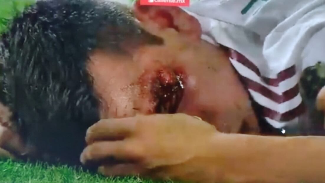 El “Chucky” Lozano sufre salvaje entrada; tuvo que abandonar el partido