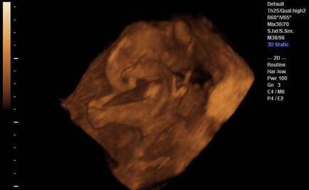 Indagan en Texas posible venta de tejidos de fetos