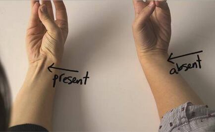 Palmar largo, músculo que refuerza la teoría de la evolución. ¿Lo tienes?