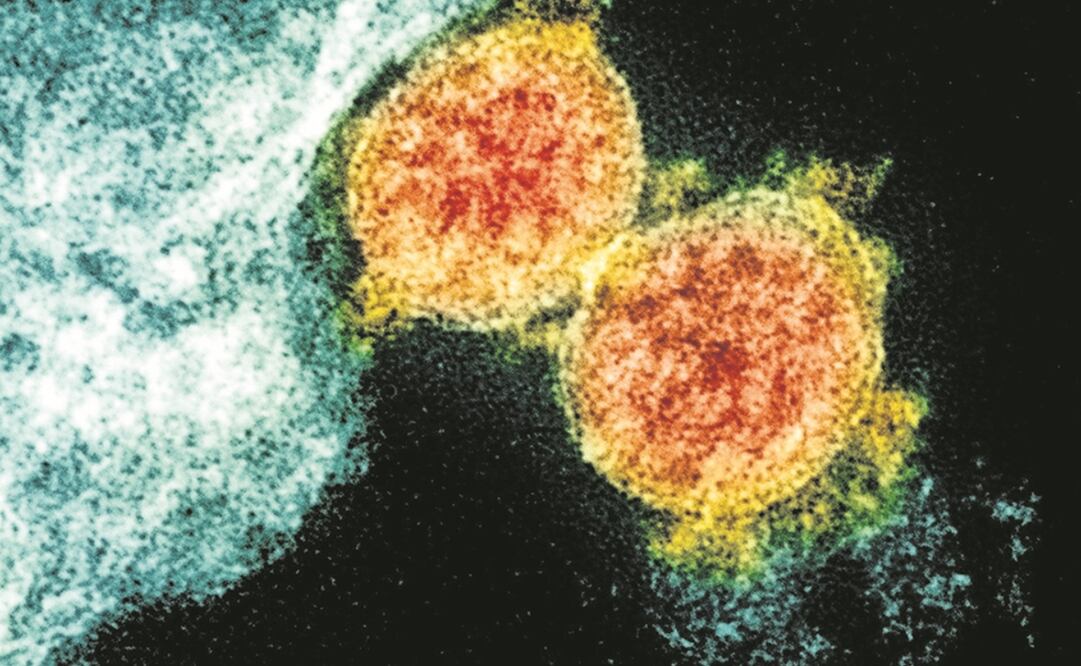 Foto: NIAID/National Institutes of Health via AP