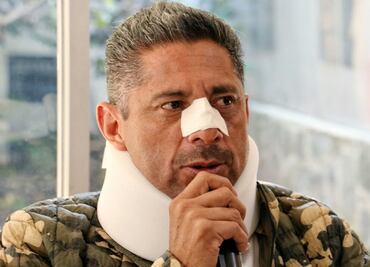 Alcalde sufrió fracturas por evitar linchamiento en Edomex