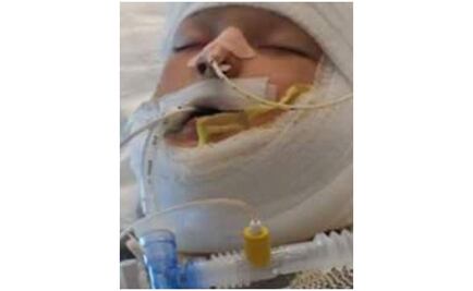 Niño víctima de bullying es quemado en Texas 