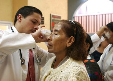 Cataracts and poverty are closely related in Mexico