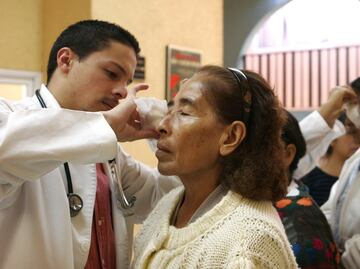 Cataracts and poverty are closely related in Mexico