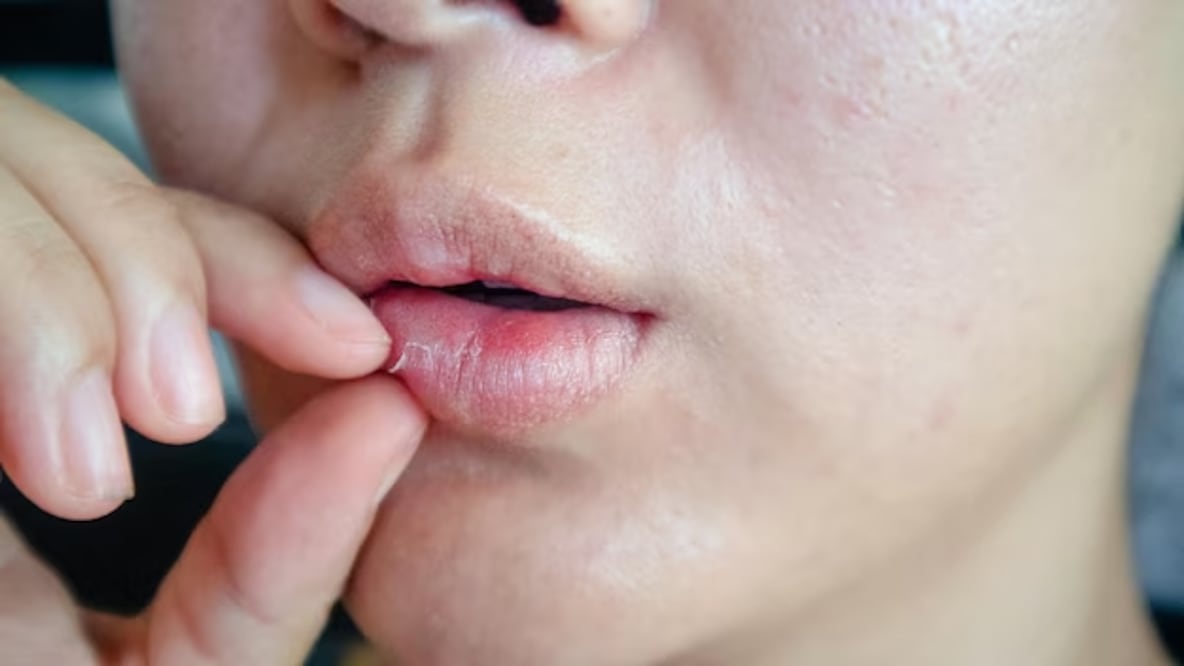 No chupes tus labios porque podrías resecarlos. Foto: Freepik