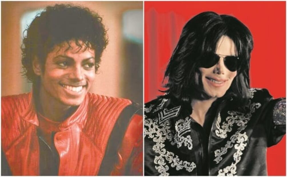 Famosos que recurren a la cirugía estética para ser mejores