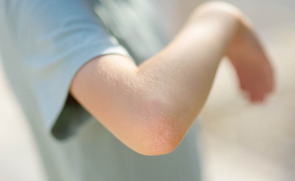 Cortesía: Centro Médico ABC