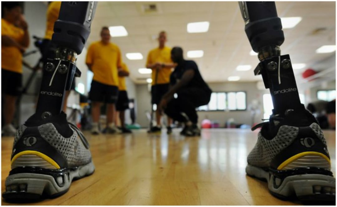 Tres jóvenes egresados de la Facultad de Ingeniería de la UNAM, decidieron juntar su talento para crear ORTEOPROTS, el nombre con el que estarán bautizados sus equipos de tecnología biónica