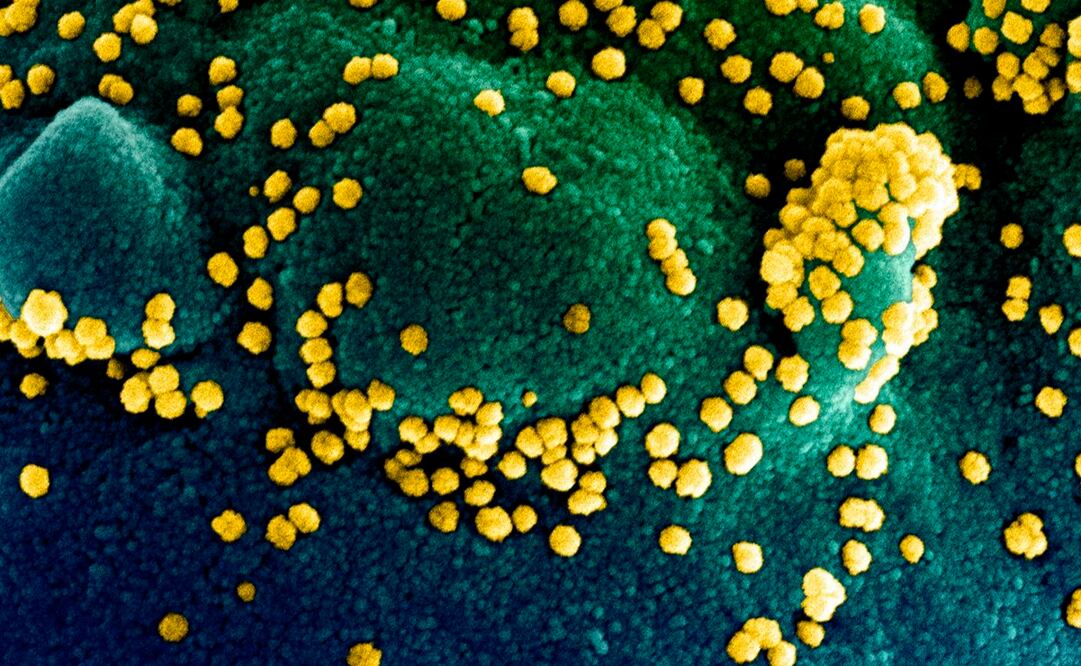 Foto: Handout / National Institute of Allergy and Infectious Diseases / AFP, archivo