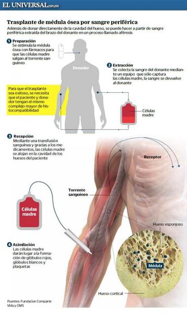 Otra oportunidad. La espera por una médula ósea