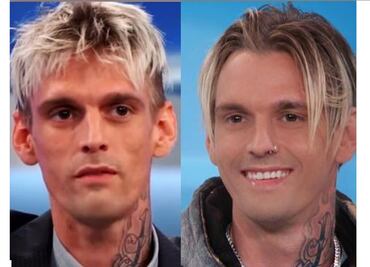 Aaron Carter padece de esquizofrenia, bipolaridad, depresión y ansiedad