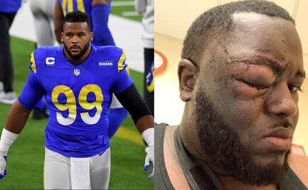 Jugador de los Rams de Los Ángeles acusado de golpear brutalmente a sujeto