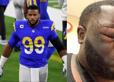 Jugador de los Rams de Los Ángeles acusado de golpear brutalmente a sujeto