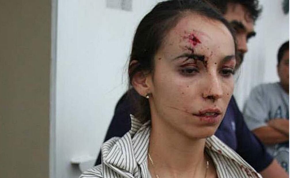 Karla Silva fueagredida en su domicilio por tres hombres presuntamente contratados por mandos policiacos. /Archivo - EL UNIVERSAL