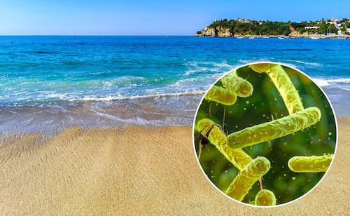 ¿Bacteria "come carne" está presente en México?; conoce qué es, sus síntomas y cómo se contagia