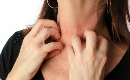 ¿Qué induce a las personas a rascarse?